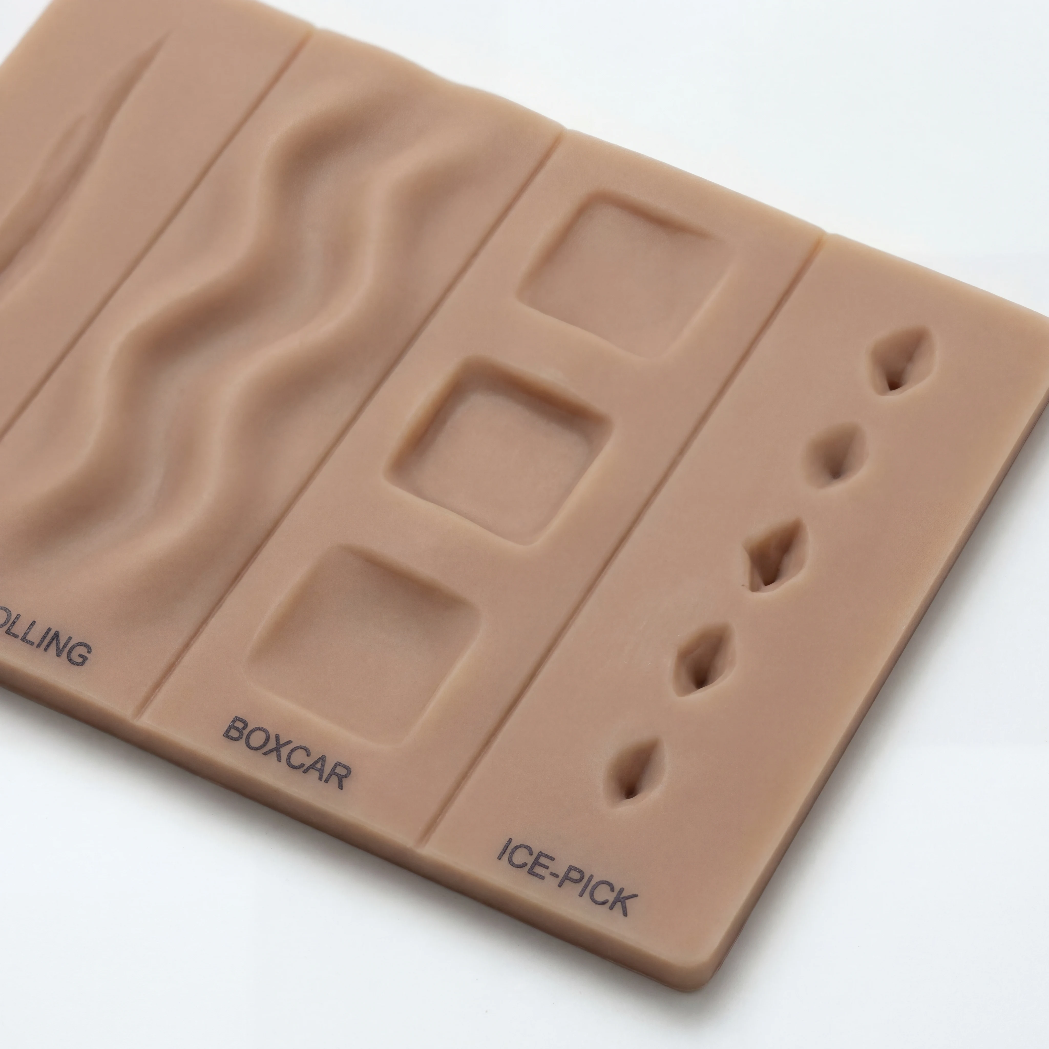 Close-up educational image showing different acne scar textures such as rolling, boxcar, and ice-pick patterns