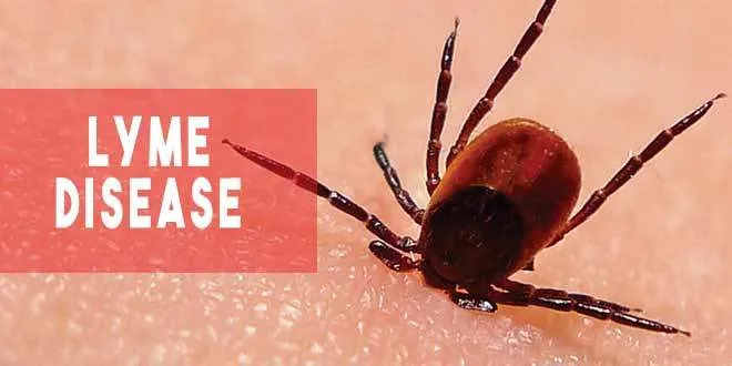 Lyme Disease Facts and Symptoms | How to Spot the Signs - Health