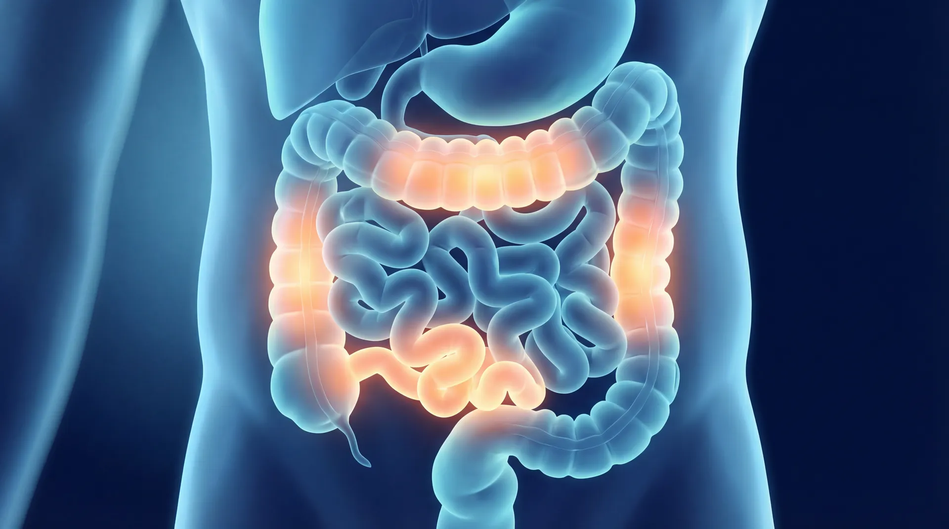Blue-toned medical illustration of the human digestive system with warm highlights on colon and terminal ileum indicating Crohn's disease inflammation areas