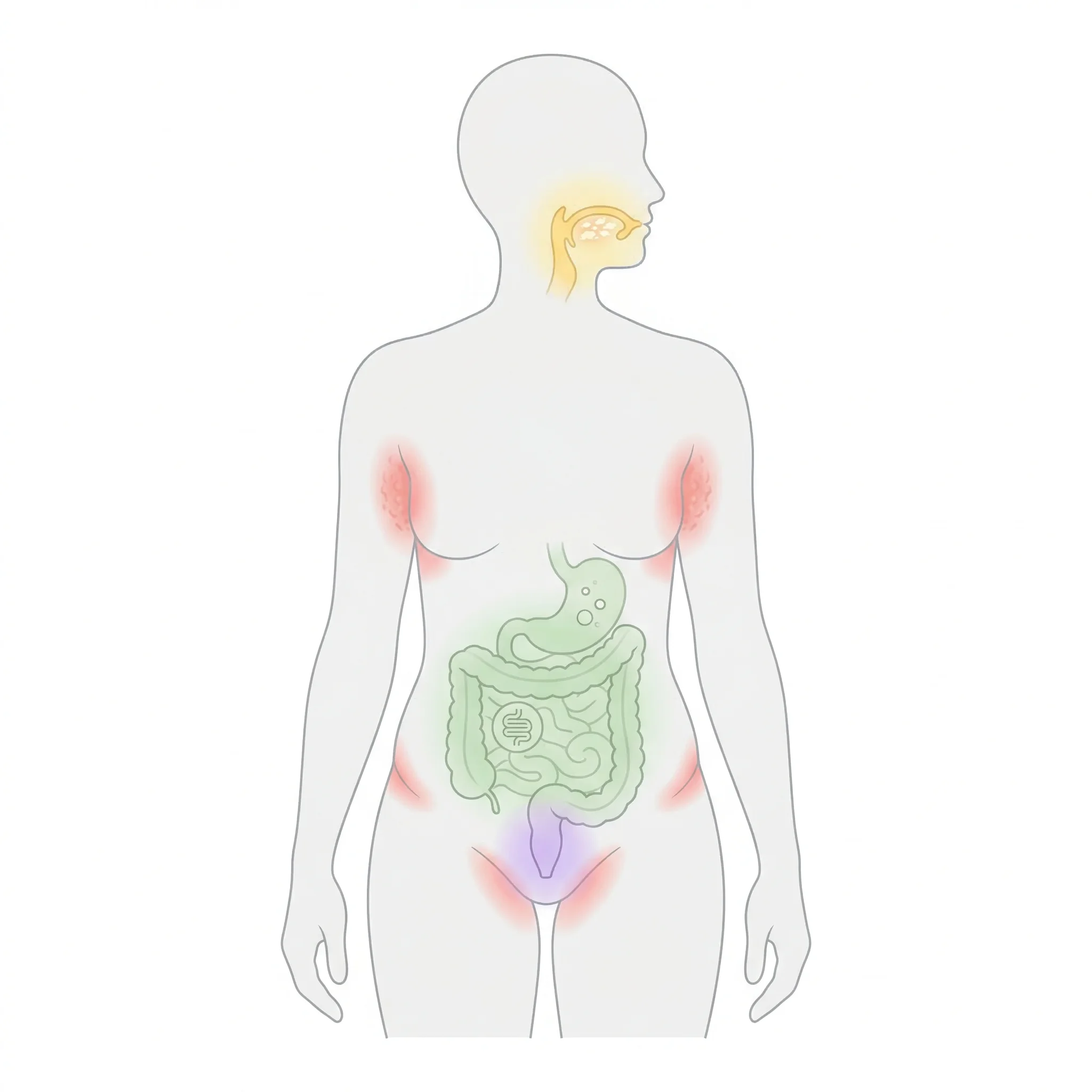 Illustrated diagram showing different body areas affected by candida overgrowth including mouth, skin, gut, and vaginal regions