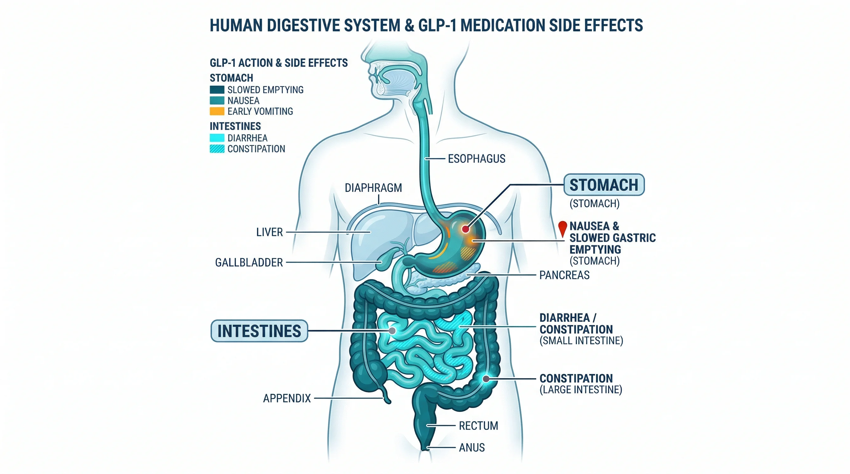 Anatomical illustration of the digestive system showing where oral semaglutide side effects commonly occur